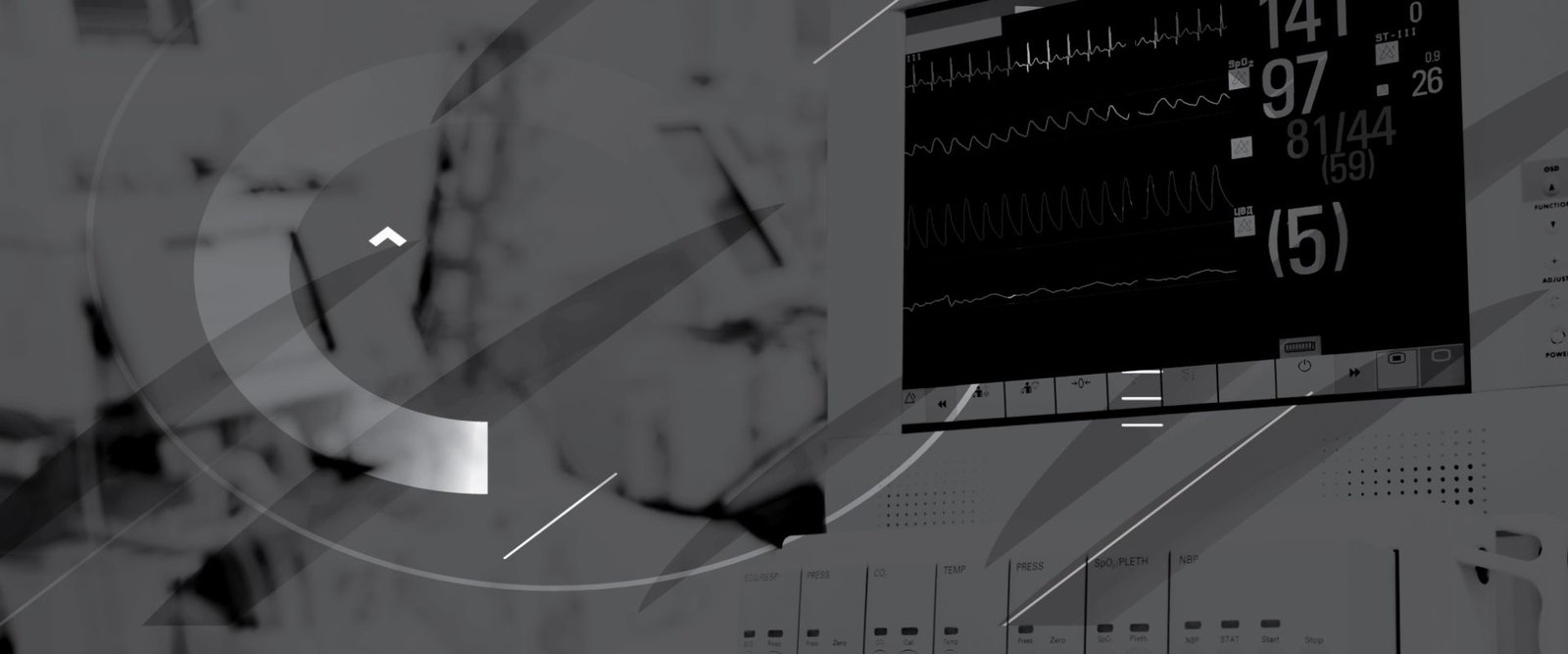identifying & management of cardiac arrest